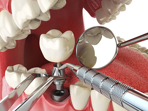 Best Emergency Gum Pain Relief  in Goulding, FL